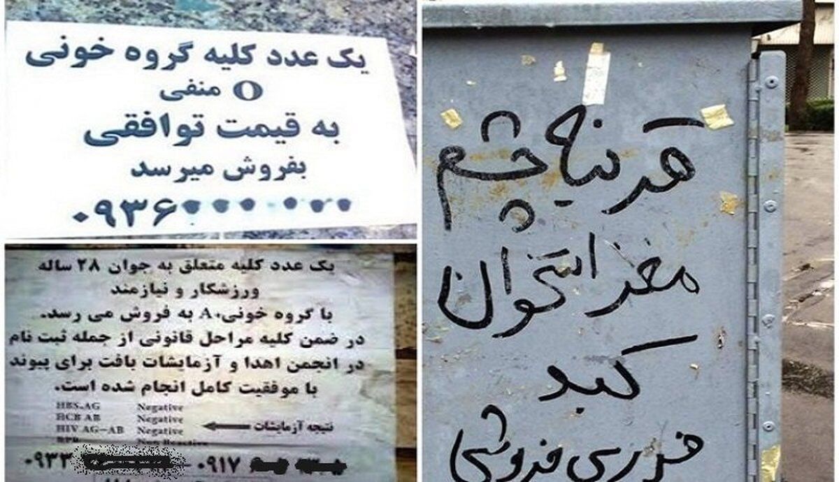 خرید‌وفروش اعضای بدن در ایران آزاد شد؟!+تصویر