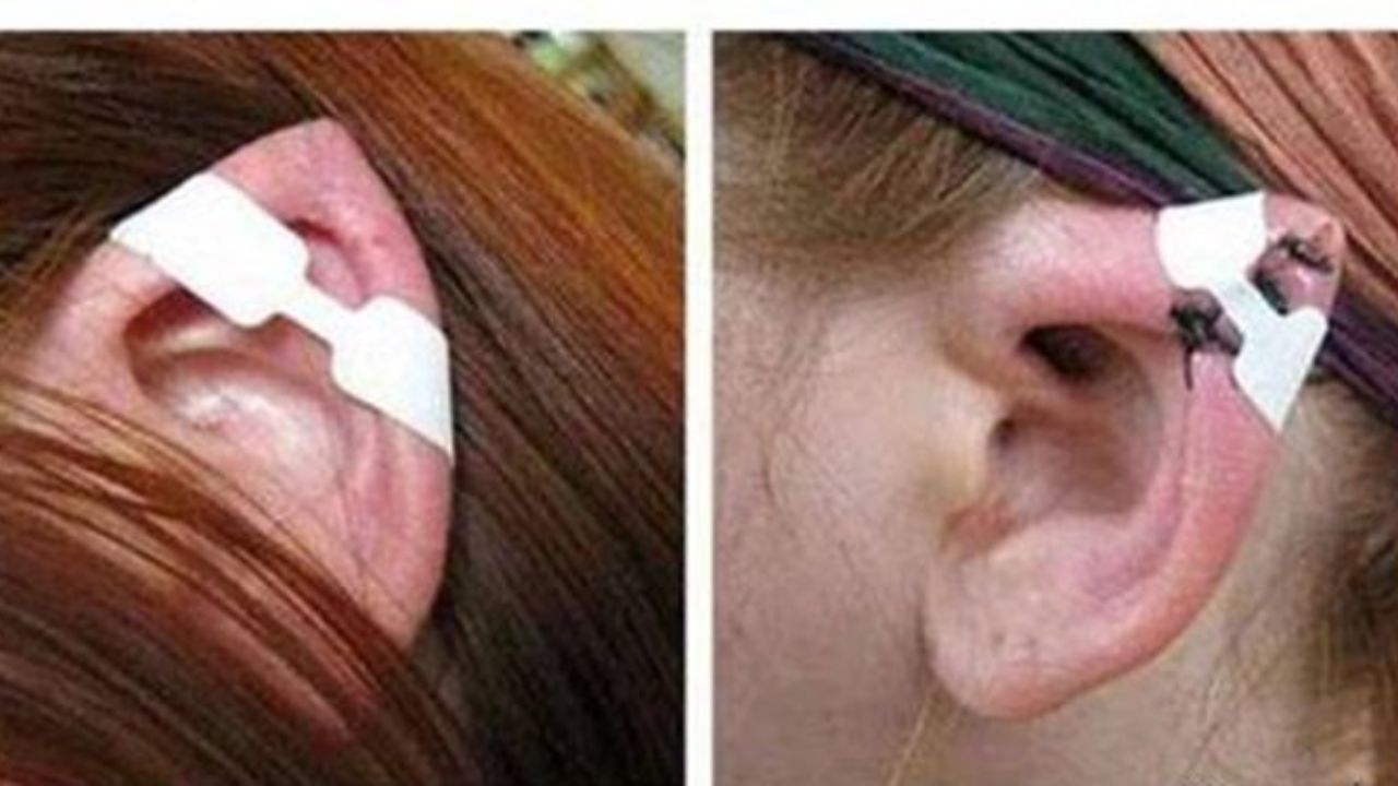 تعقیب کیفری در انتظار جراحی‌های نامتعارف