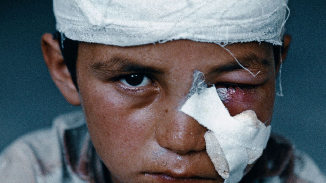 تبلیغات خلاقانه| این‌ها ماسک هالووین نیست (تصاویر ناراحت‌کننده)