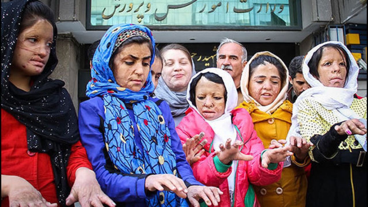 حادثه دیدگان شین‌آباد به خارج از کشور اعزام نمی‌شوند