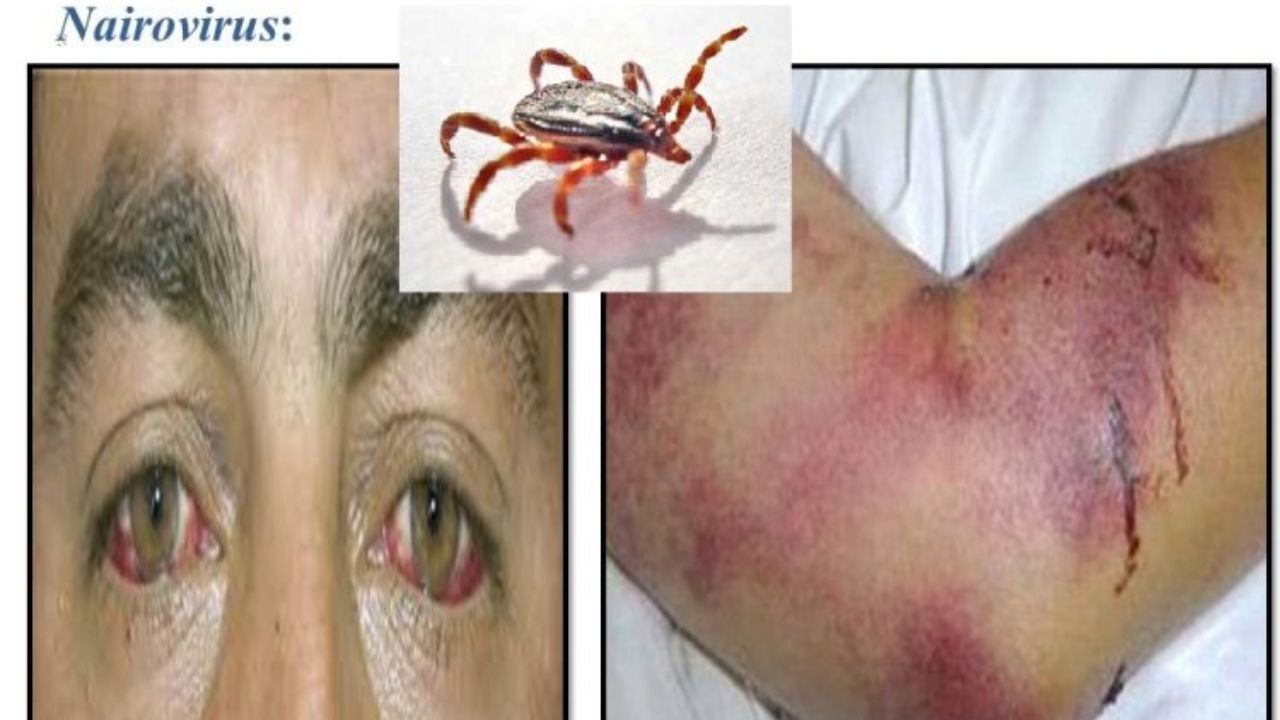 ابتلا به تب کریمه کنگو در نطنز گزارش نشده است