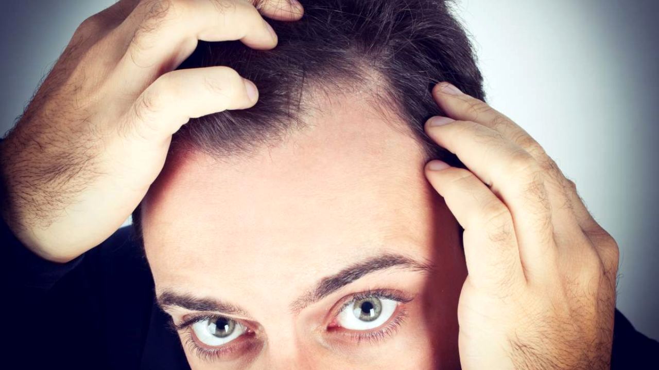 تعادل چربی پوست سر ارتباط مستقیم با شوره دارد