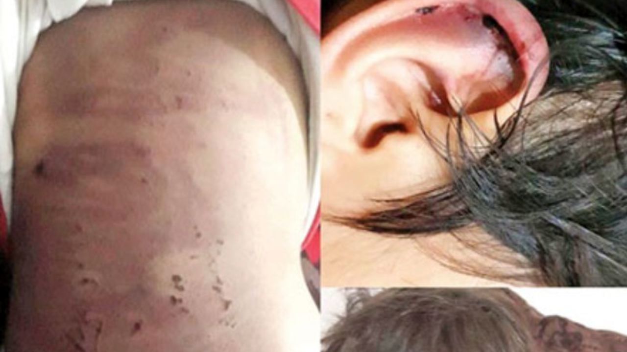 حمایت روانی برای ستایش 5 ساله