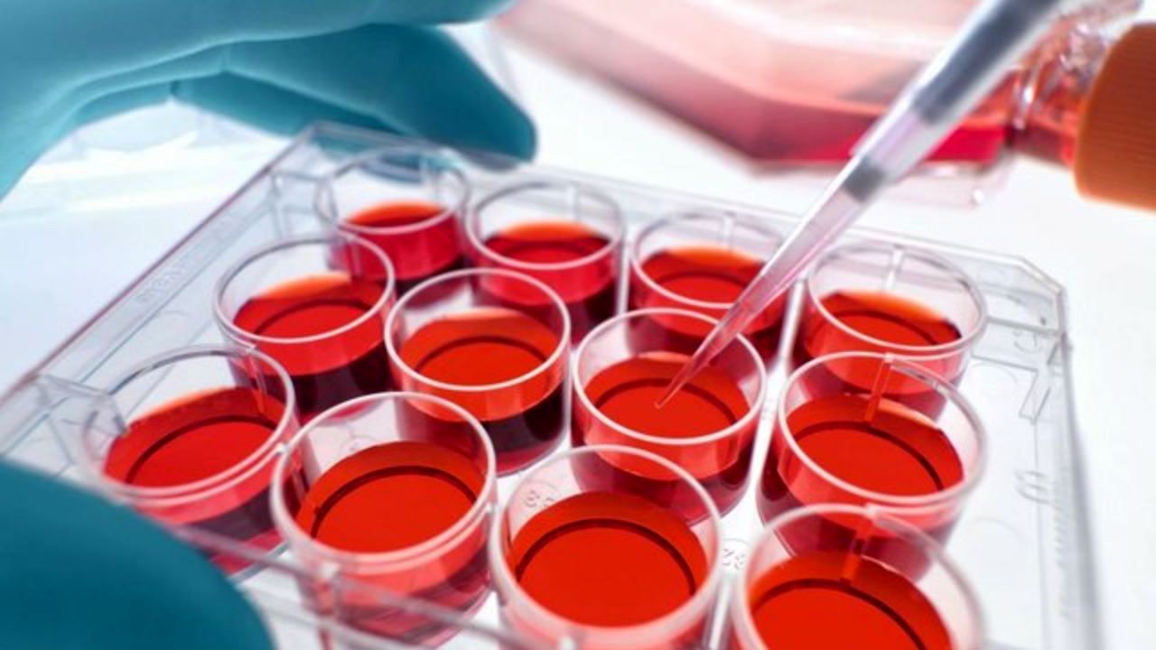 طرحی برای درمان سرطان به کمک سلول‌های خون بند ناف