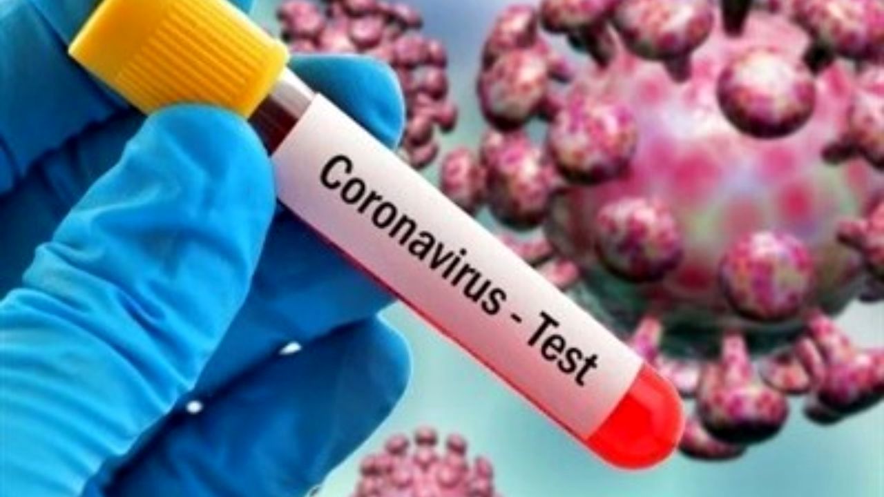 «بولیوی» و «جامائیکا» هم کرونایی شدند