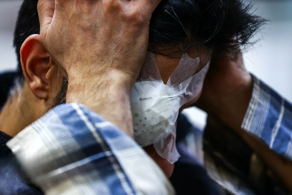آخرین آمار حوادث چهارشنبه‌سوری؛ ۱۶ کشته و ۳۹۹۹ مصدوم / ۱۸۶ نفر قطع عضو شدند