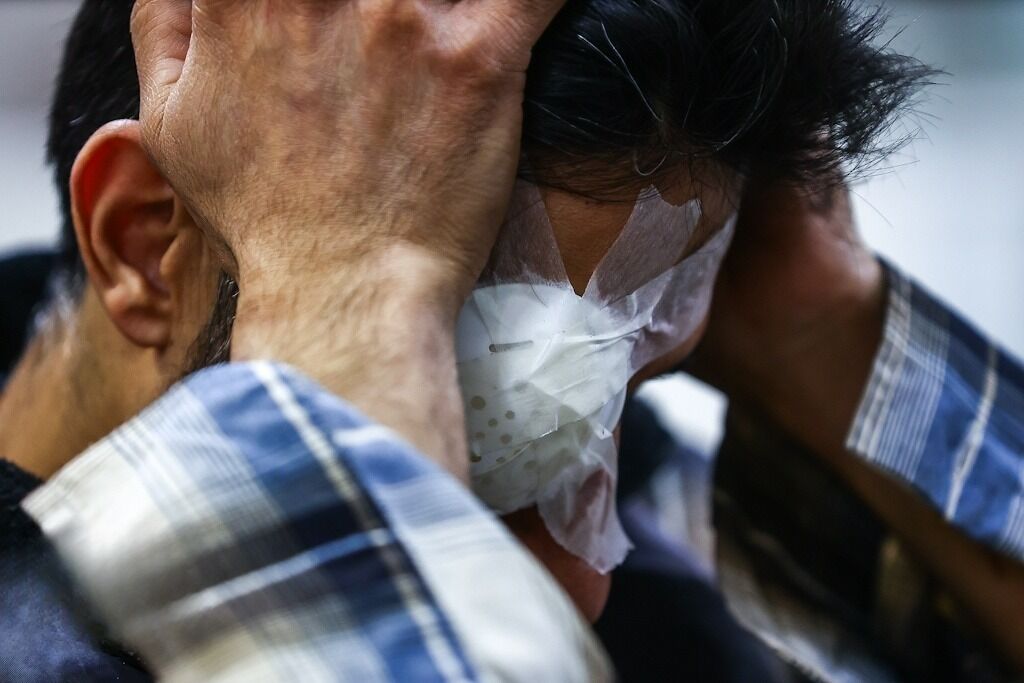 آخرین آمار حوادث چهارشنبه‌سوری؛ ۱۶ کشته و ۳۹۹۹ مصدوم / ۱۸۶ نفر قطع عضو شدند