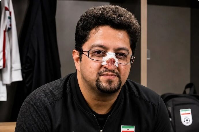شادی گل آفساید شجاع به مصر تلافات داد/ دماغ مربی تیم ملی شکست!