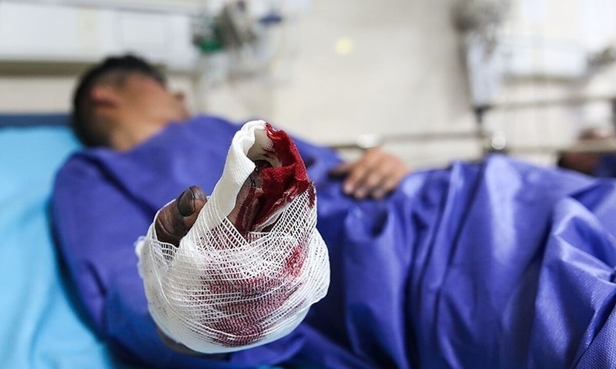 10 فوتی و 424 مصدوم بر اثر حوادث چهارشنبه‌سوری