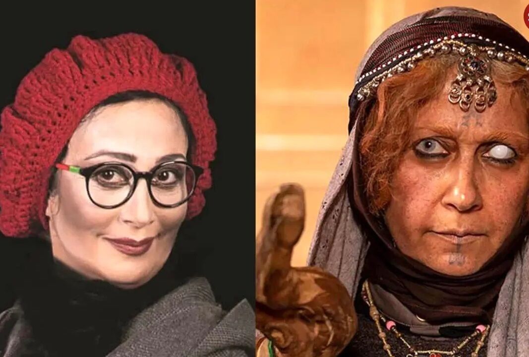 بهناز نازی، بازیگر، در پی مبارزه با سرطان به خواب مصنوعی رفت