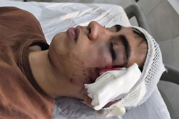 دانش‌آموز بمی قربانی خشونت معلم شد/ وعده احقاق حق از سوی آموزش‌وپرورش