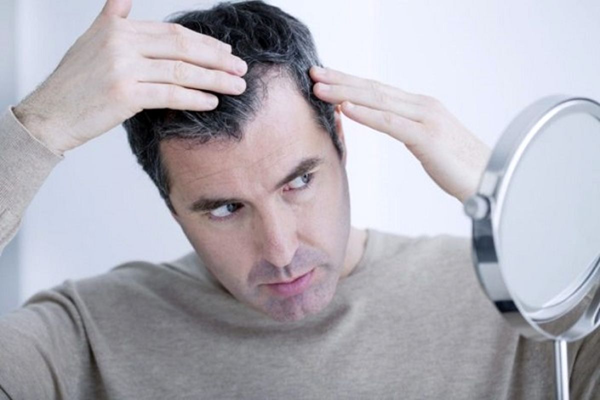 جلوگیری از ریزش مو با این توصیه ساده طب‌سنتی