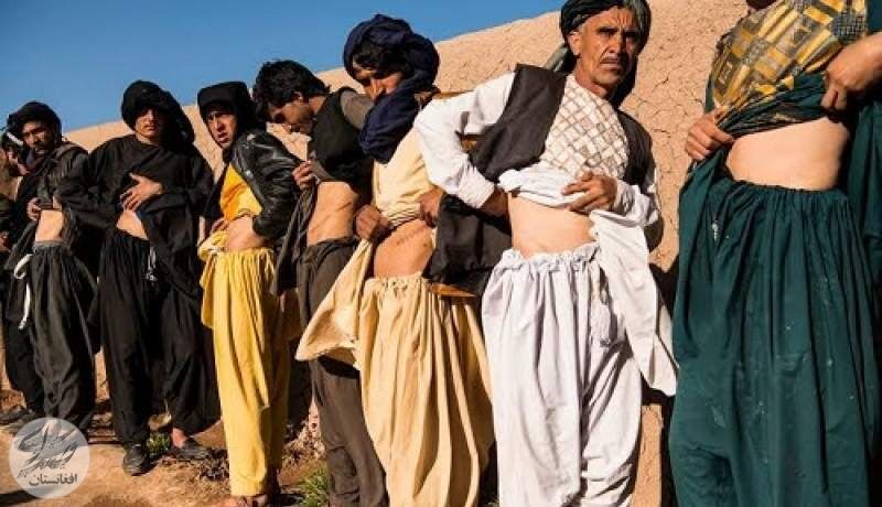 مردم افغانستان مجبور به فروش کلیه‌های خود شده‌اند!